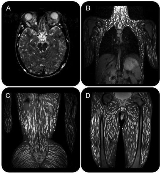 偷吃野味不仅仅是冠状病毒缠身