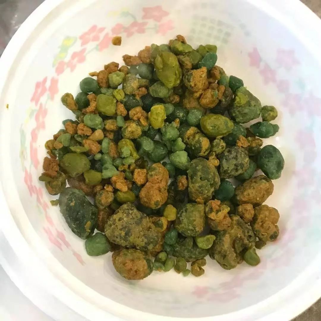 男子7天排出100多颗你想过自己肝胆有多脏吗