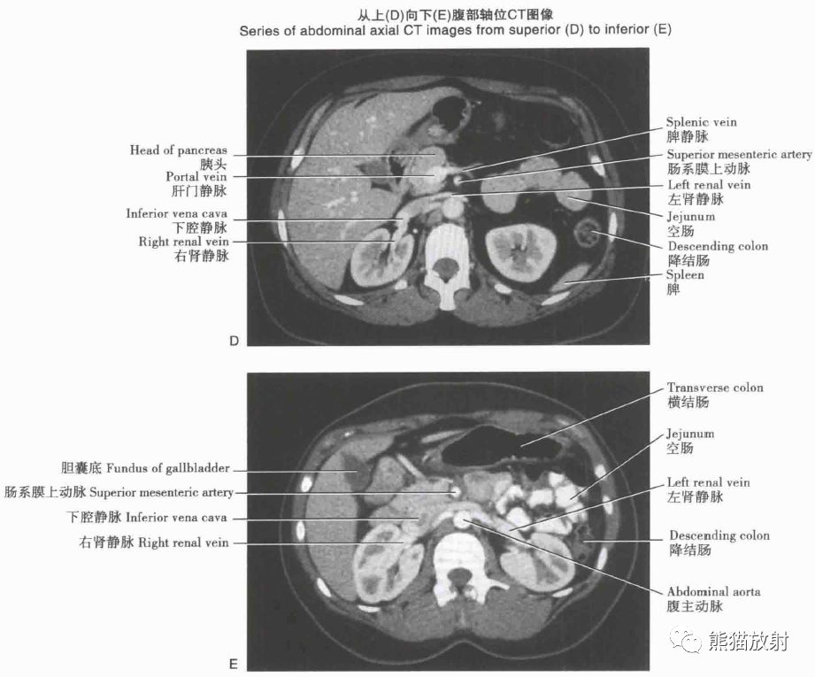 解剖丨肝、胆、胰、脾（动脉、门脉属支）_血管