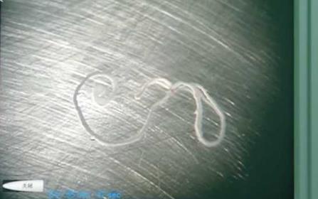 男子生吞蛇胆20年后医生开颅时被眼前一幕惊呆