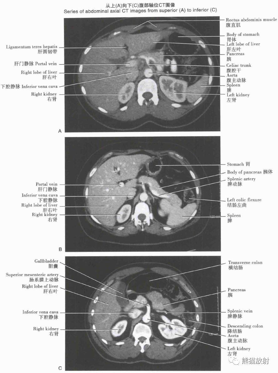 解剖丨肝、胆、胰、脾（动脉、门脉属支）_血管