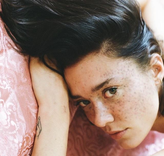 颠覆世俗美的另类模特满脸雀斑塌鼻子却成娱乐宠儿