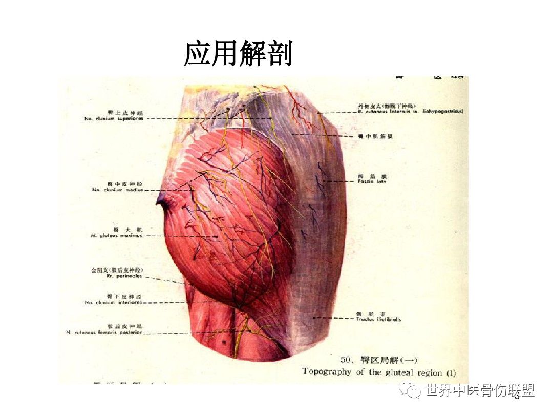 臀肌攣縮症