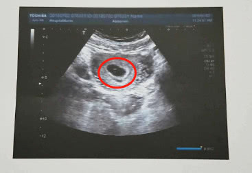 怀孕50天胎儿图图片