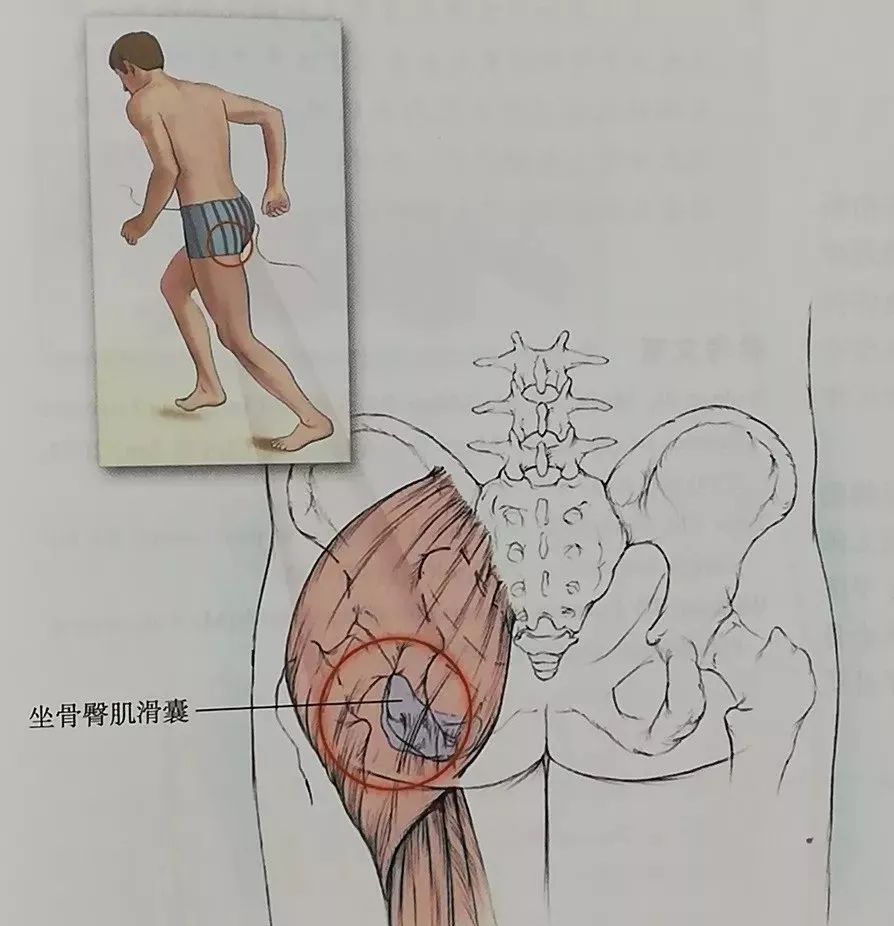 坐骨滑囊位于臀大肌和坐骨结节之间