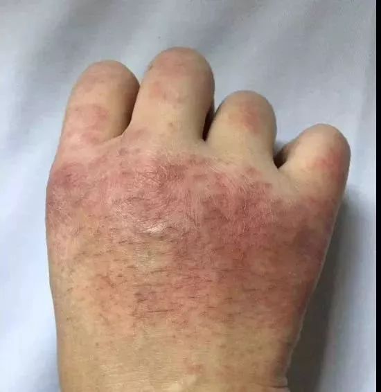 90后女护士的手,白发母亲的视频,环卫大叔的心意…病