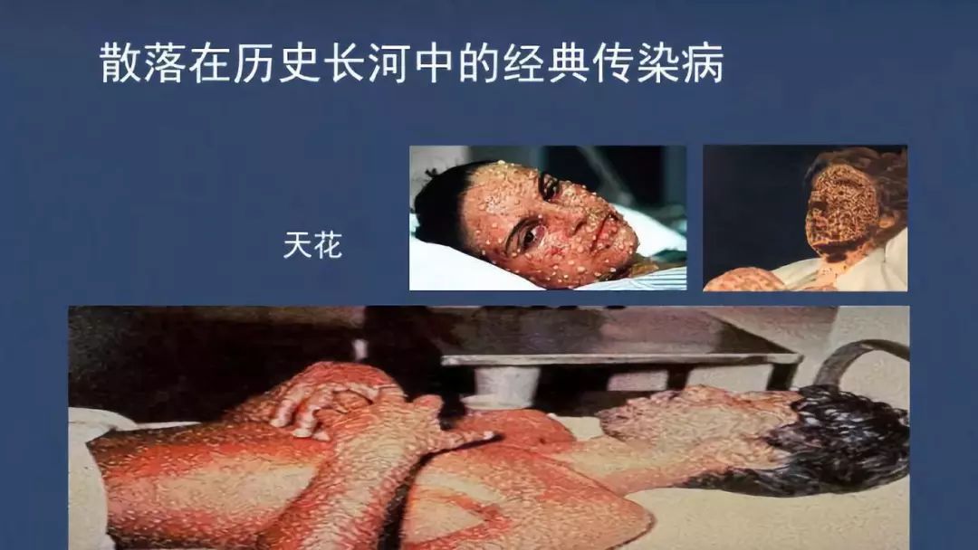 中国最后的天花病人图片
