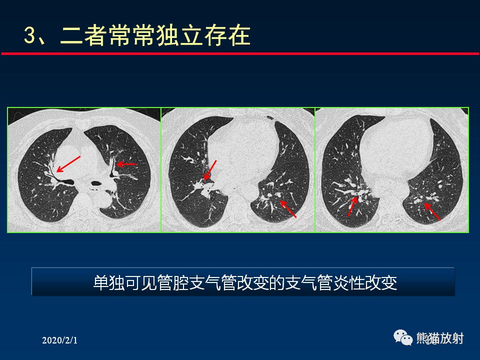 柳澄讲坛丨精准判读支气管感染的基本ct表现