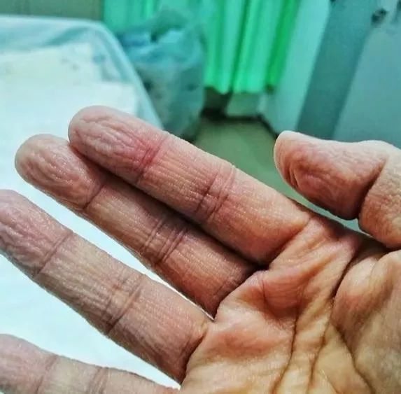 致敬 这双"天使之手"疫情防控 龙江巾帼在行动义无反顾奔赴工作岗位舍