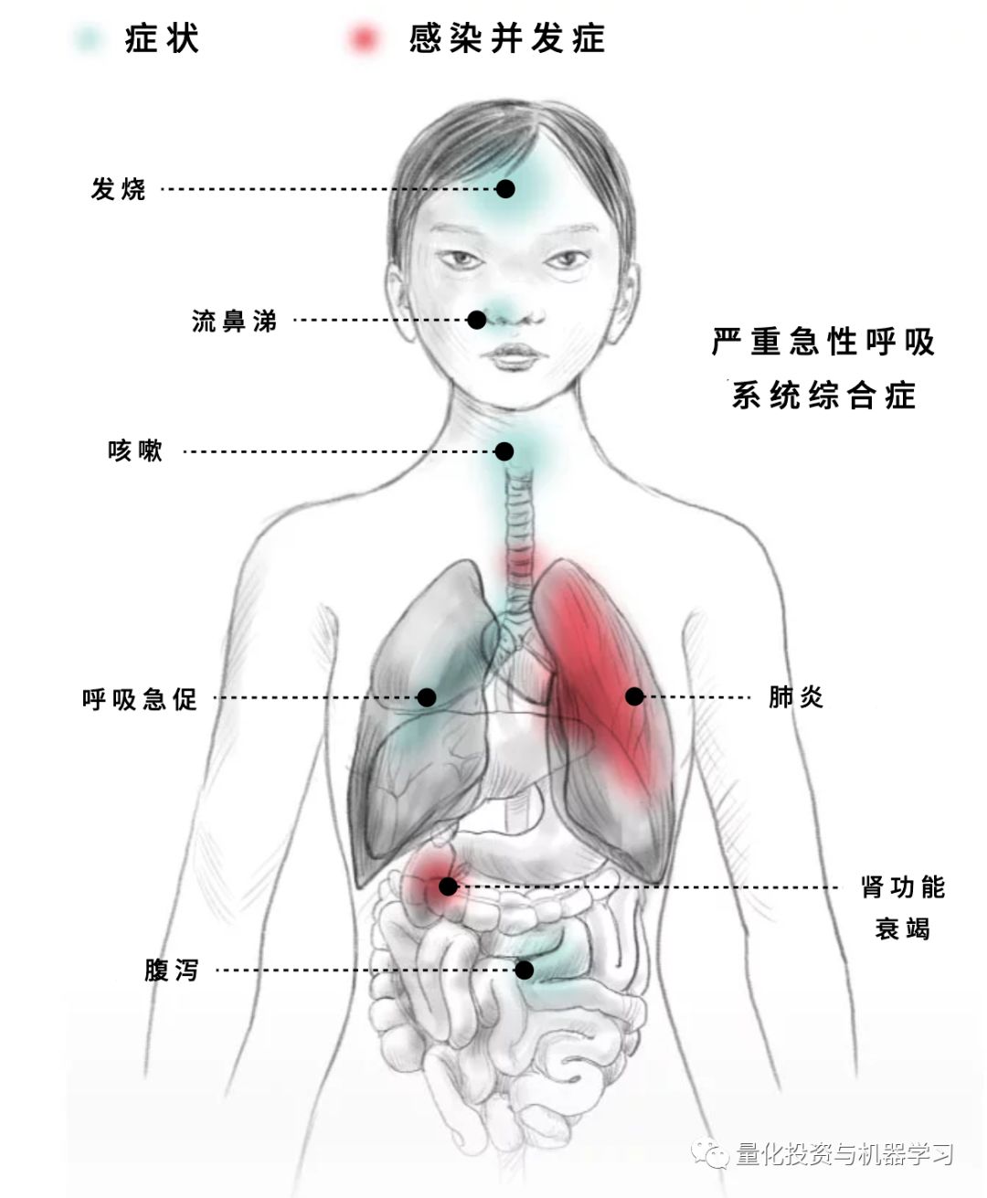 人体图肺疼在什么位置图片