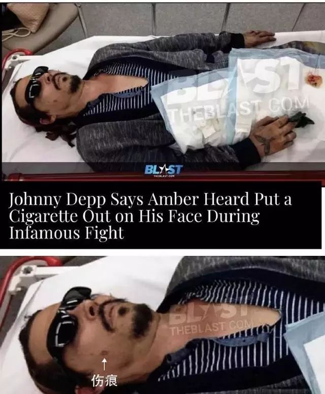 into my body and head, including heavy bottles, soda cans