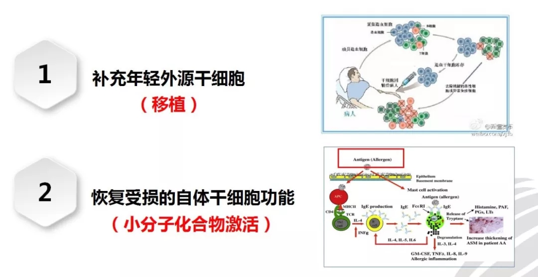 重大消息干细胞疗法已应用于新型冠状病毒治疗