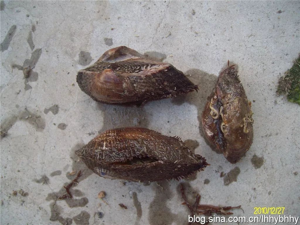 你还记得1988年的上海甲肝大爆发吗