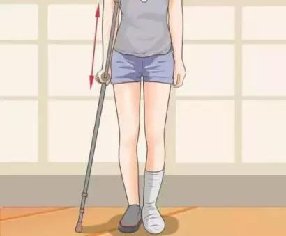 对于截肢患者,患肢是不能提供下肢支撑的,这个时候就是需要拐杖代替患
