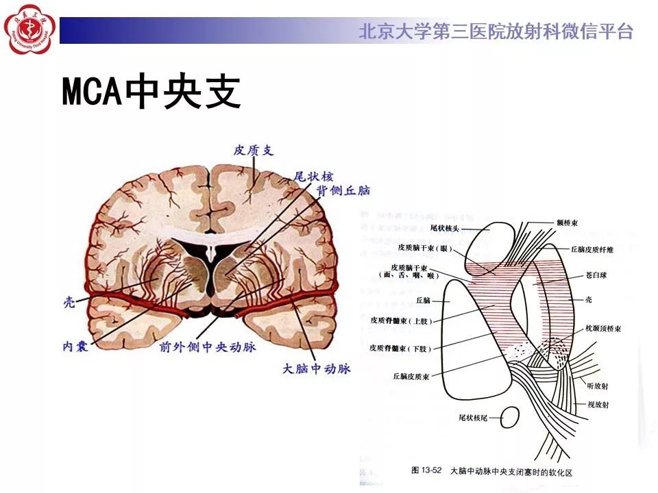 解剖| 超全腦動脈解剖及供血區分佈