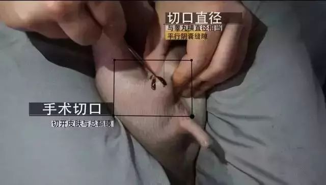 专扯男子睾丸图片