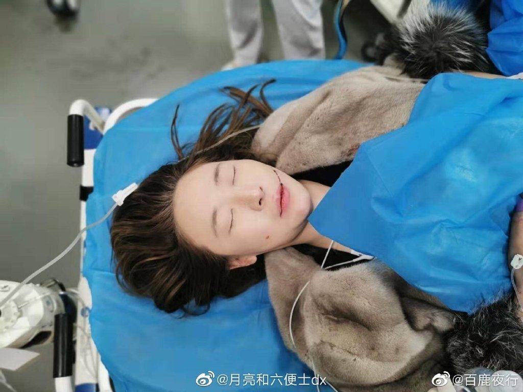 厦门环岛路发生重大交通事故,有人晒出女车主被推到医院的图片