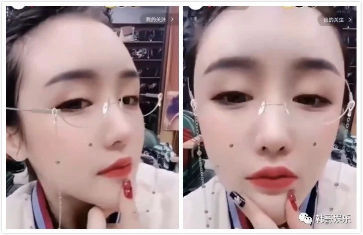 原创黑暗萝莉大美整容安装假体二嫂夸辰轩周珍是牛郎织女