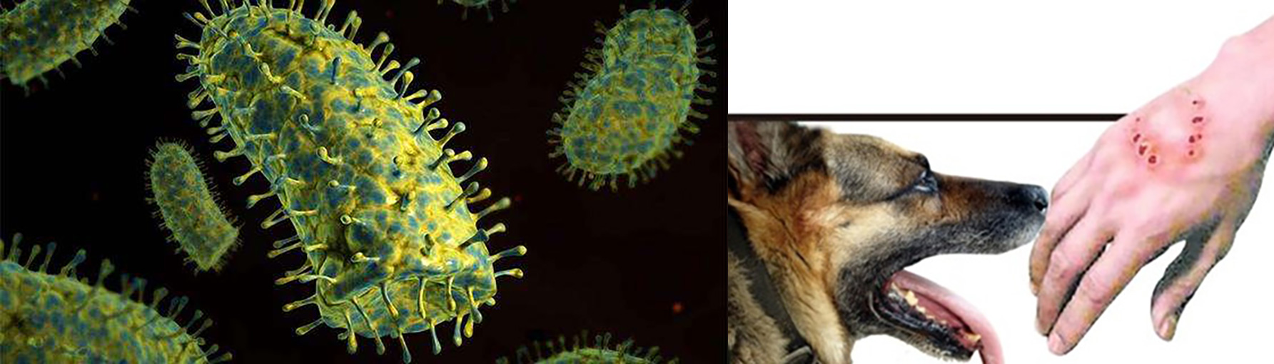 狂犬病毒包涵体图片图片
