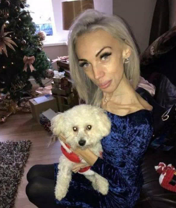 英国23岁姑娘瘦到只有25公斤,全身皮包骨,康复后变女神_hannah