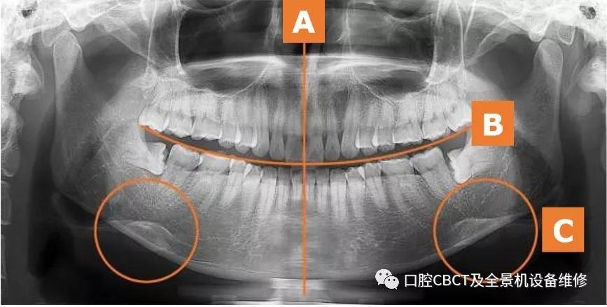 口腔全景x光机建议操作流程及注意事项