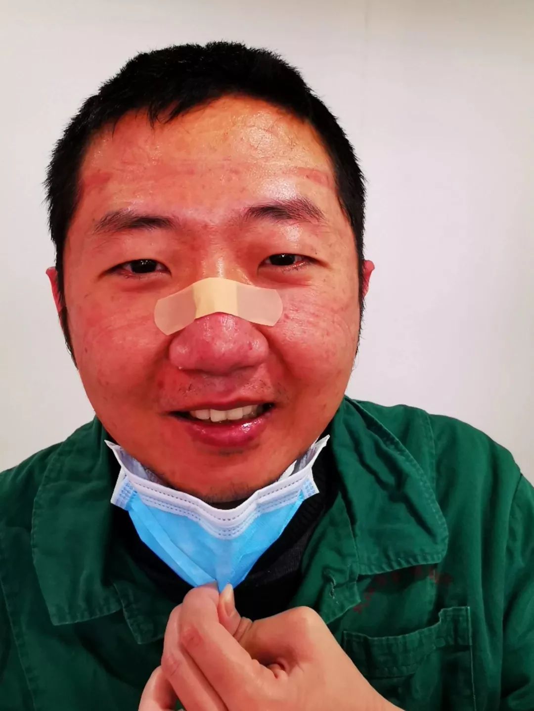 全身汗湿满脸勒痕过敏红肿这是他们最美的战绩