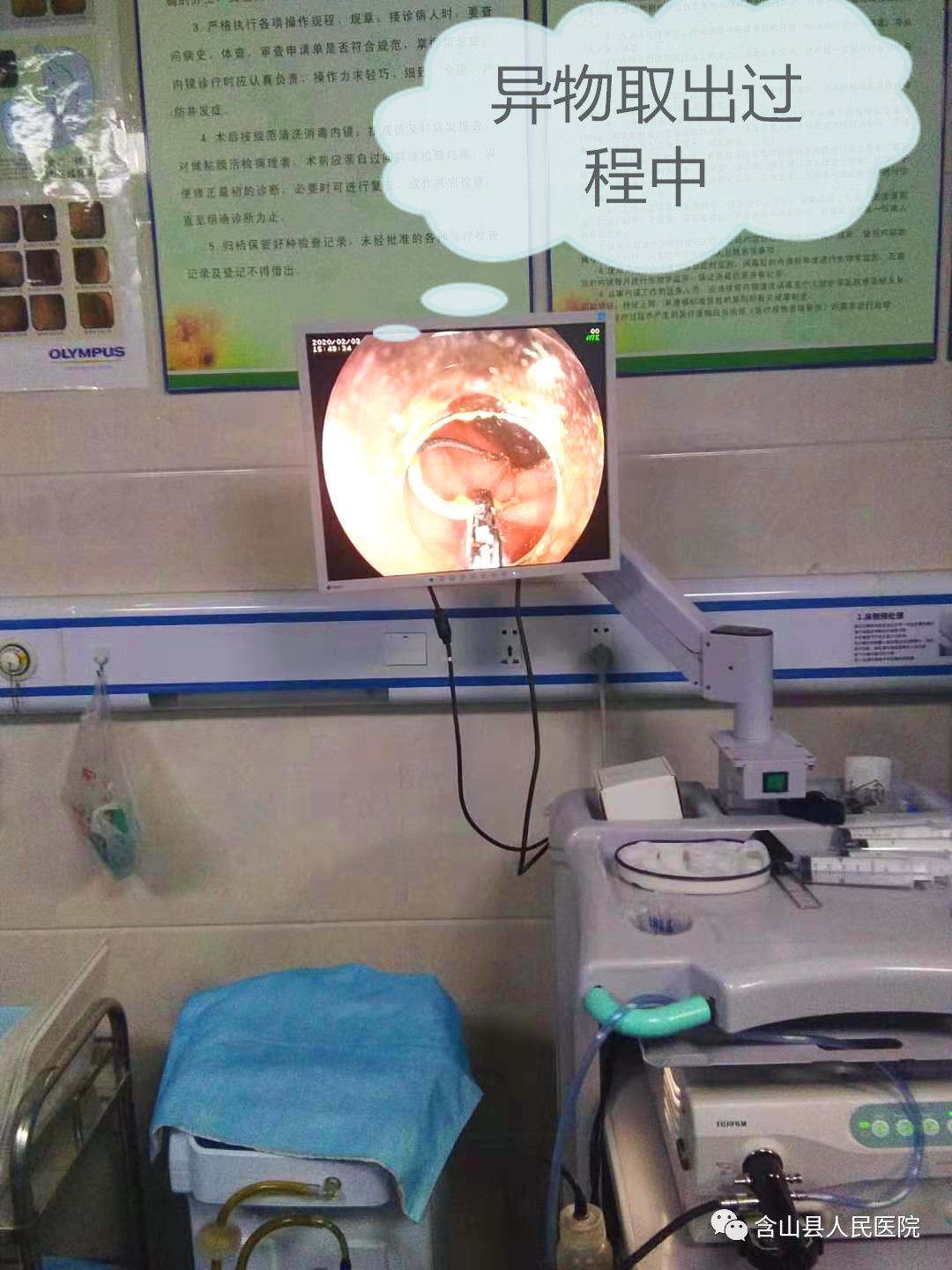 含山一6岁男孩太顽皮将20cm的铁丝塞入肛门中送医成功取出