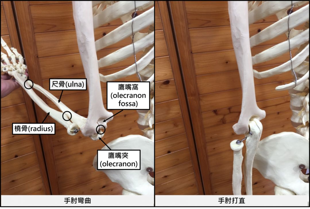 的鷹嘴突與肱骨的鷹嘴窩,橈尺關節也無法吻合接續向上檢查了手肘關節