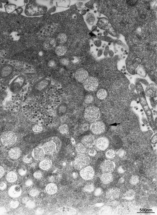 新冠病毒显微镜下图片图片