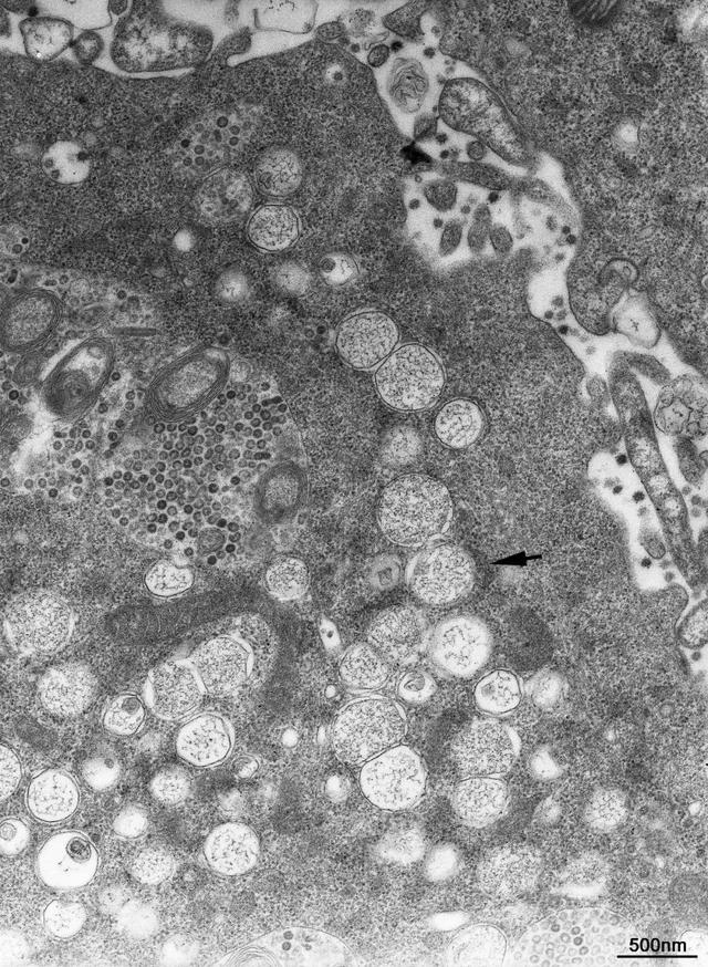 德尔塔病毒显微镜图片