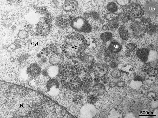 电子显微镜下的冠状病毒
