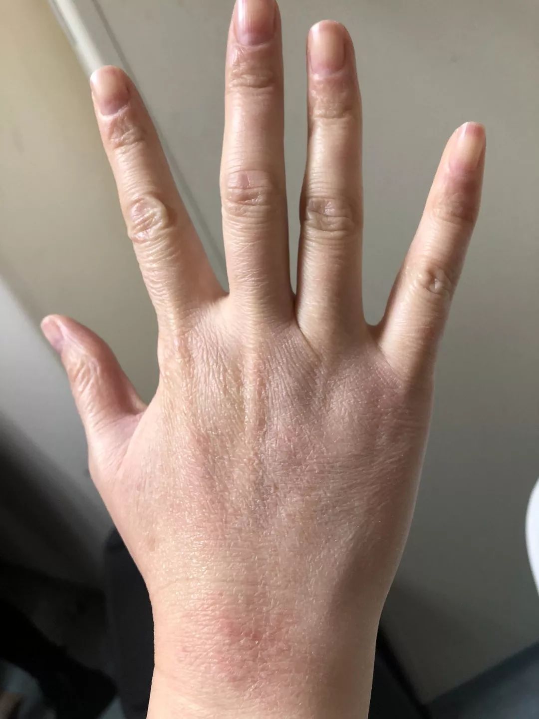 口罩不离身消毒酒精当护手霜特殊日子里如何保护你的皮肤