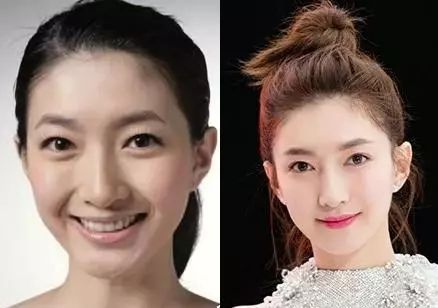 明星也驾驭不了的低颅顶毁容要怎么破解