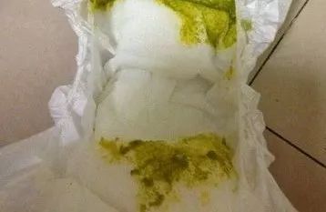 一部分消化液包括胆汁也随大便排出,此时大便就呈黄绿色带粘液,比较稀