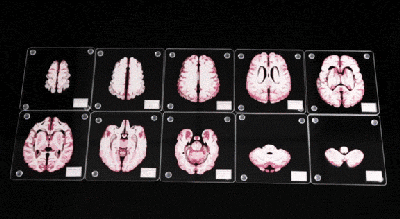 惊悚这个从实验室里偷出来的大脑切片你敢用么