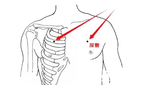 立春后用刮痧法散乳腺结节不伤身散结快