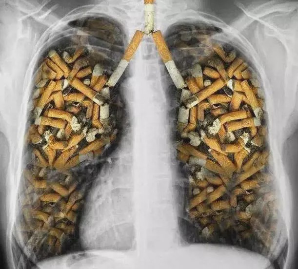 长期吸烟的人,若出现四种表现,肺部多数已病变,三件事尽早戒掉