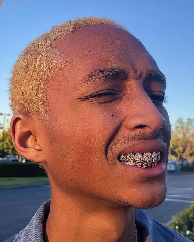 从rapper到品牌grillz牙饰什么时候开始偷偷流行的