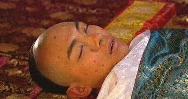 原创古时瘟疫天花有多可怕清朝整个皇室都惨遭蹂躏