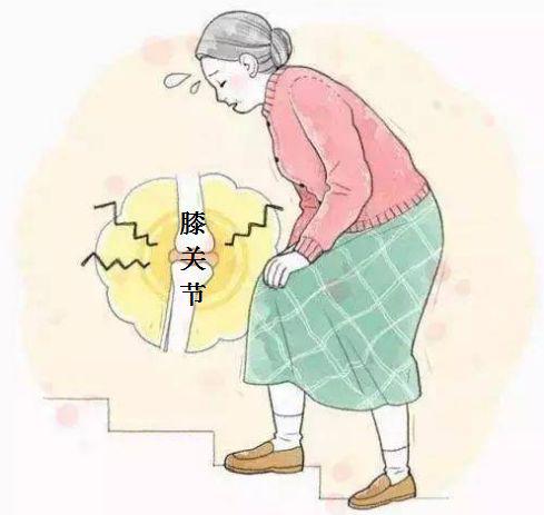 膝关节骨性关节炎又称增生性膝关节炎,老年性膝关节炎,临床上以中老年
