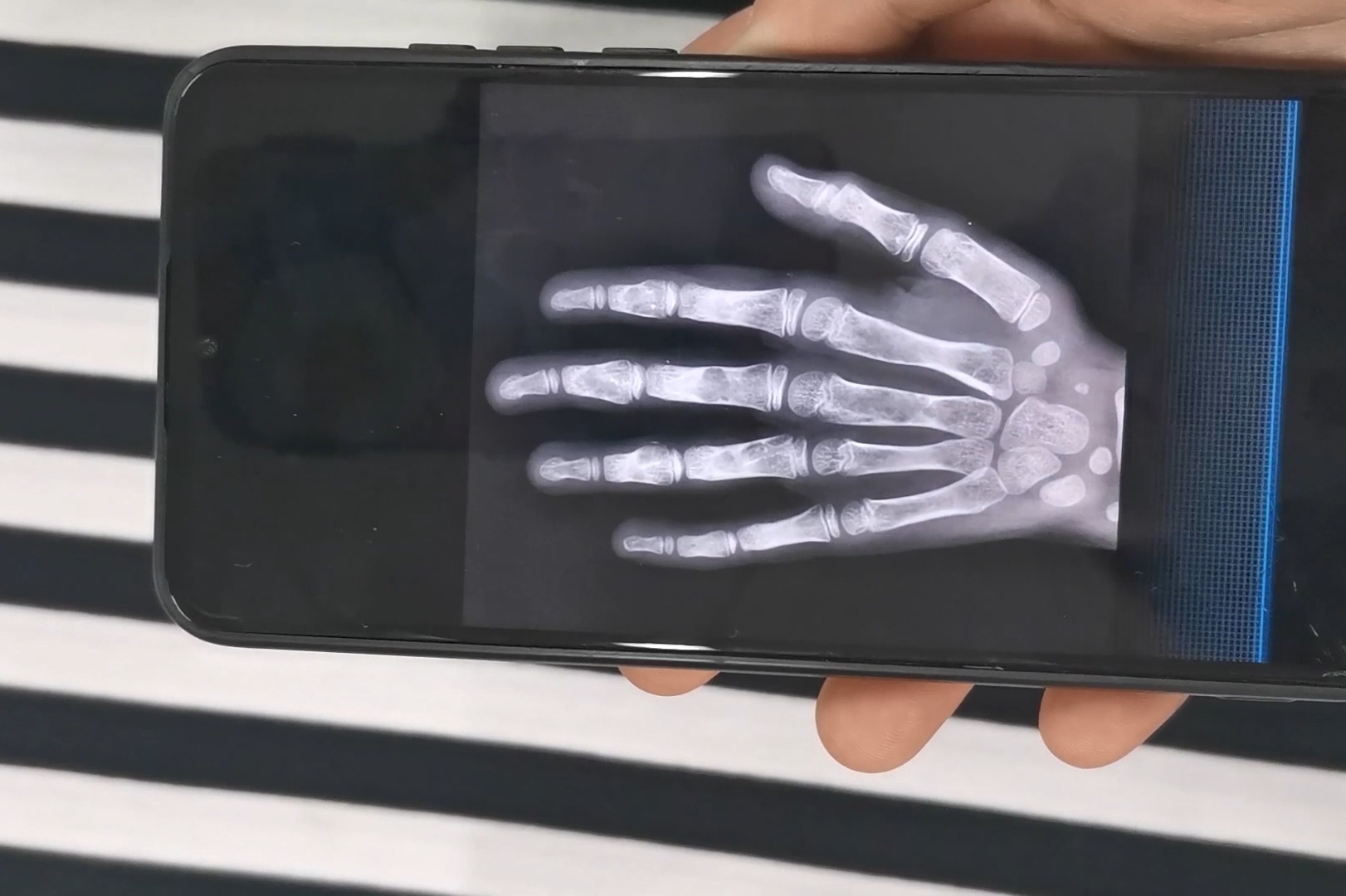 gai手机原来也可以变成x光扫描仪手掌骨骼看得清清楚楚太神