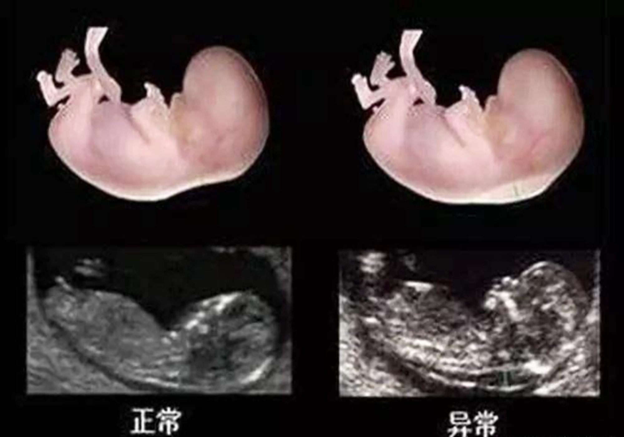 海豹胎胎儿图片
