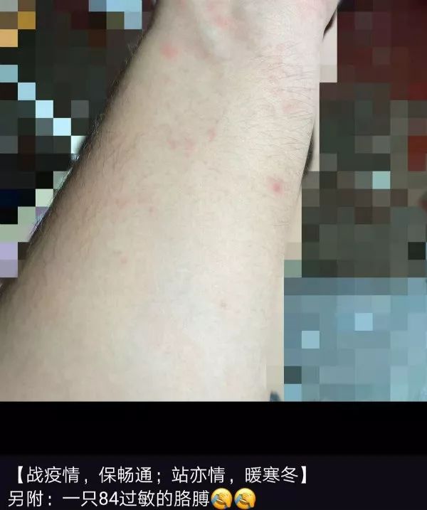 "手"01就应该是"天使的印记"吧被护目镜模糊的双眼被消毒液侵蚀的手那