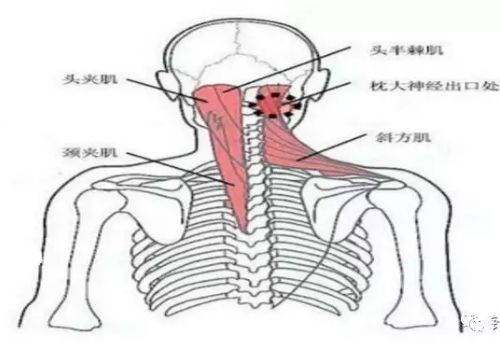 該處為頭半棘肌,枕大神經的出口處,枕骨粗隆下,頸項痠痛者這兩處—般