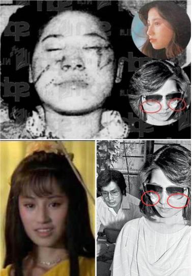 悲惨的戴良纯被一婚丈夫暴打毁容二婚前夫又砍死了三婚老公