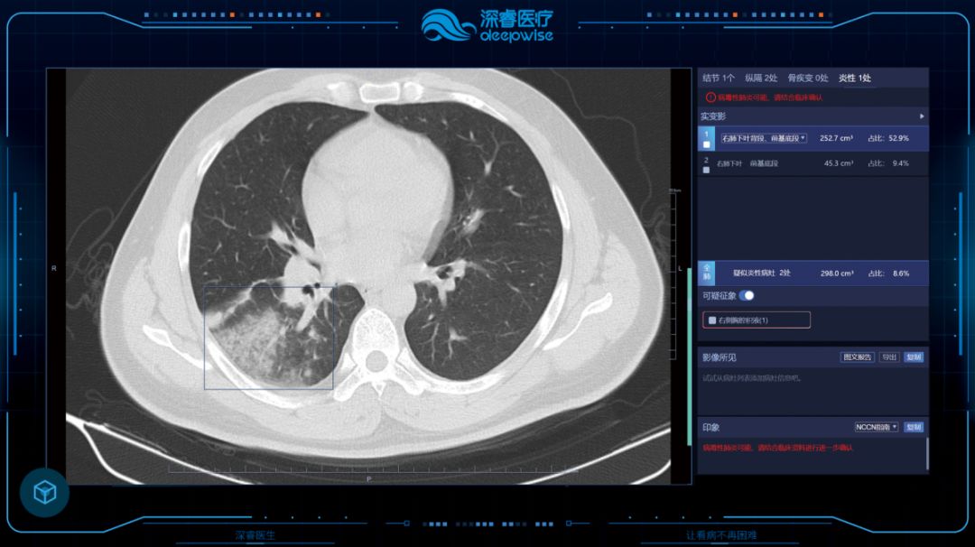副理事长单位在行动 深睿医疗向武汉第九医院捐赠ai医学辅助诊断