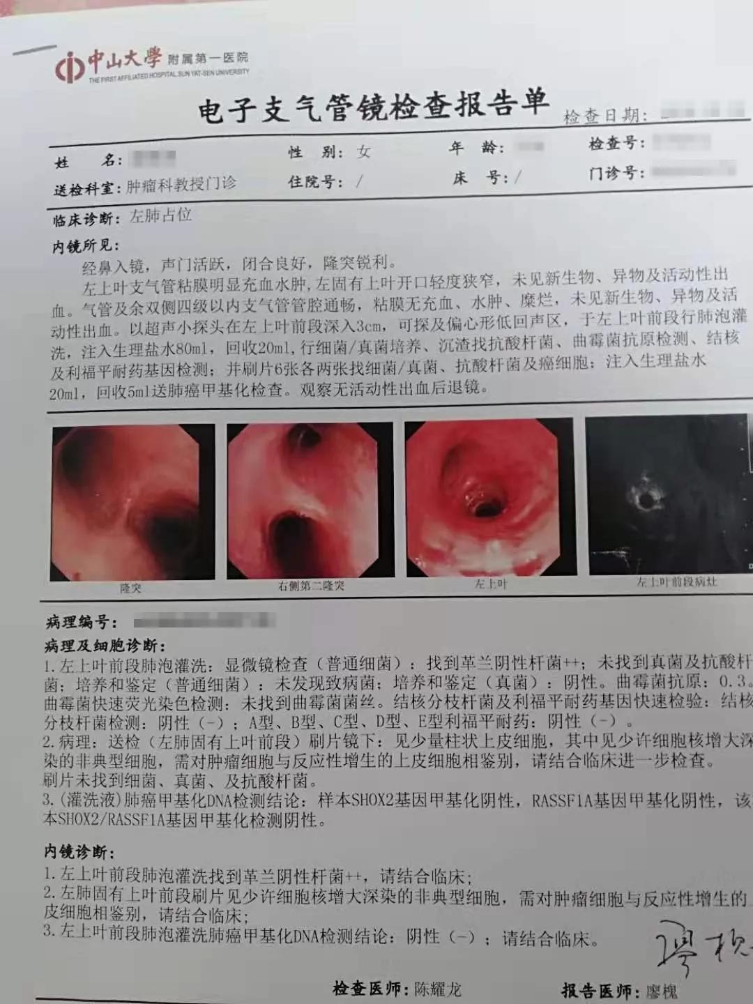 陳碧琴醫師肺部結節與發燒咳嗽乏力咽喉痛