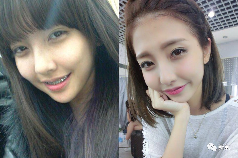 严肃分析原生条件那么好的豆得儿为什么越来越脸崩鼻孔缩没了