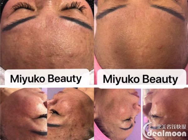 比起巩俐和国际章斋藤飞鸟的口罩脸真不算什么