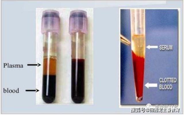 康复者献血治疗背面:血浆成分需严格处理,临床指标向好,多机构呼吁捐献血浆_患者